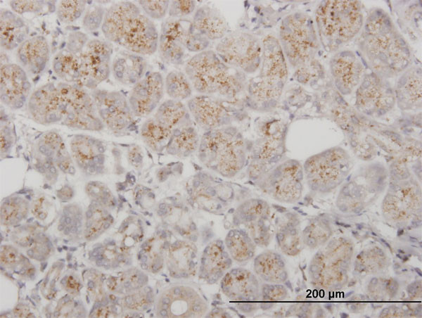 PPT1 Antibody in Immunohistochemistry (Paraffin) (IHC (P))