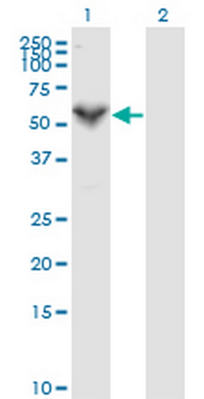 PRF1 Antibody in Western Blot (WB)