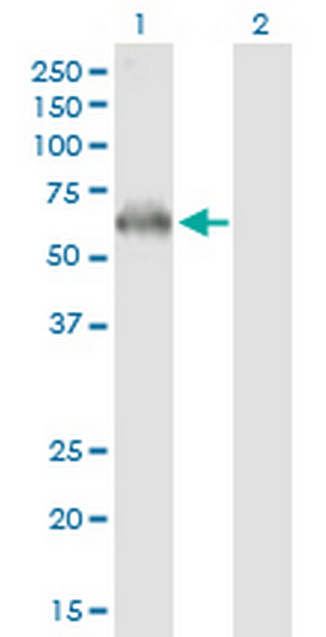 PRKAA2 Antibody in Western Blot (WB)