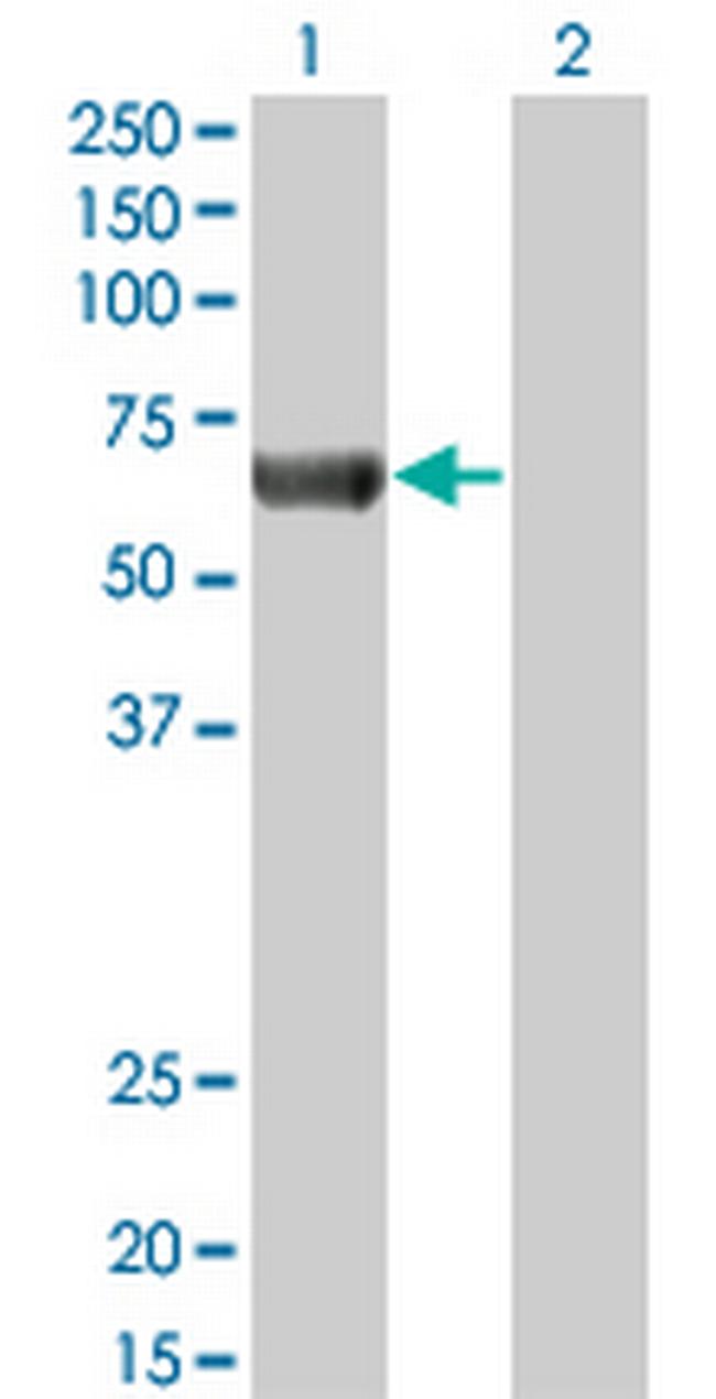 PRKAA2 Antibody in Western Blot (WB)