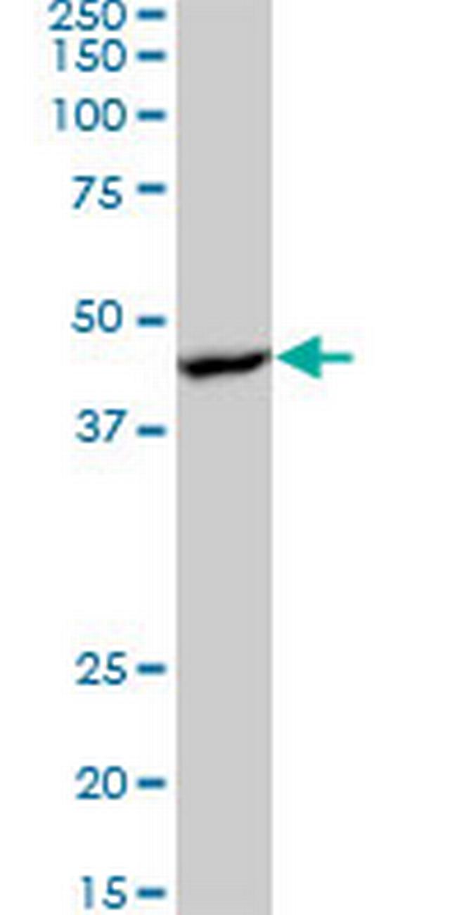 PRKAB1 Antibody in Western Blot (WB)