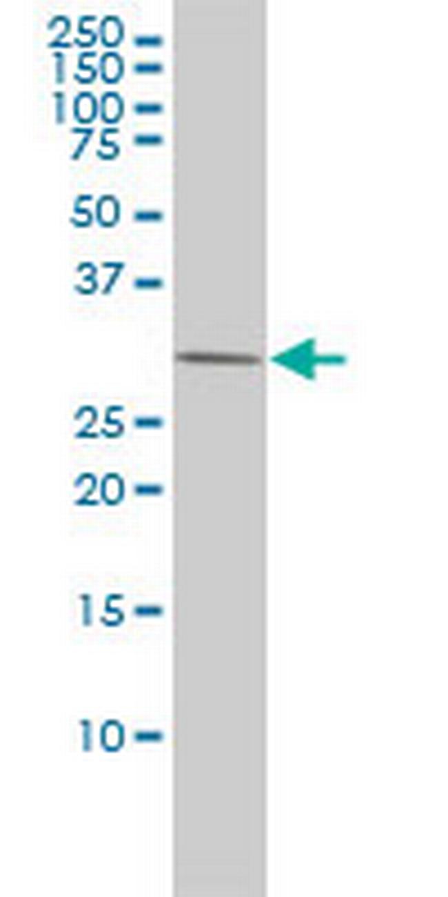 PRKAB2 Antibody in Western Blot (WB)