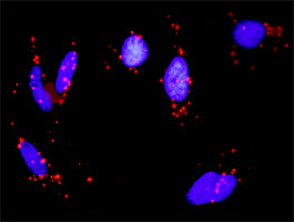 PRKACA Antibody in Proximity Ligation Assay (PLA) (PLA)