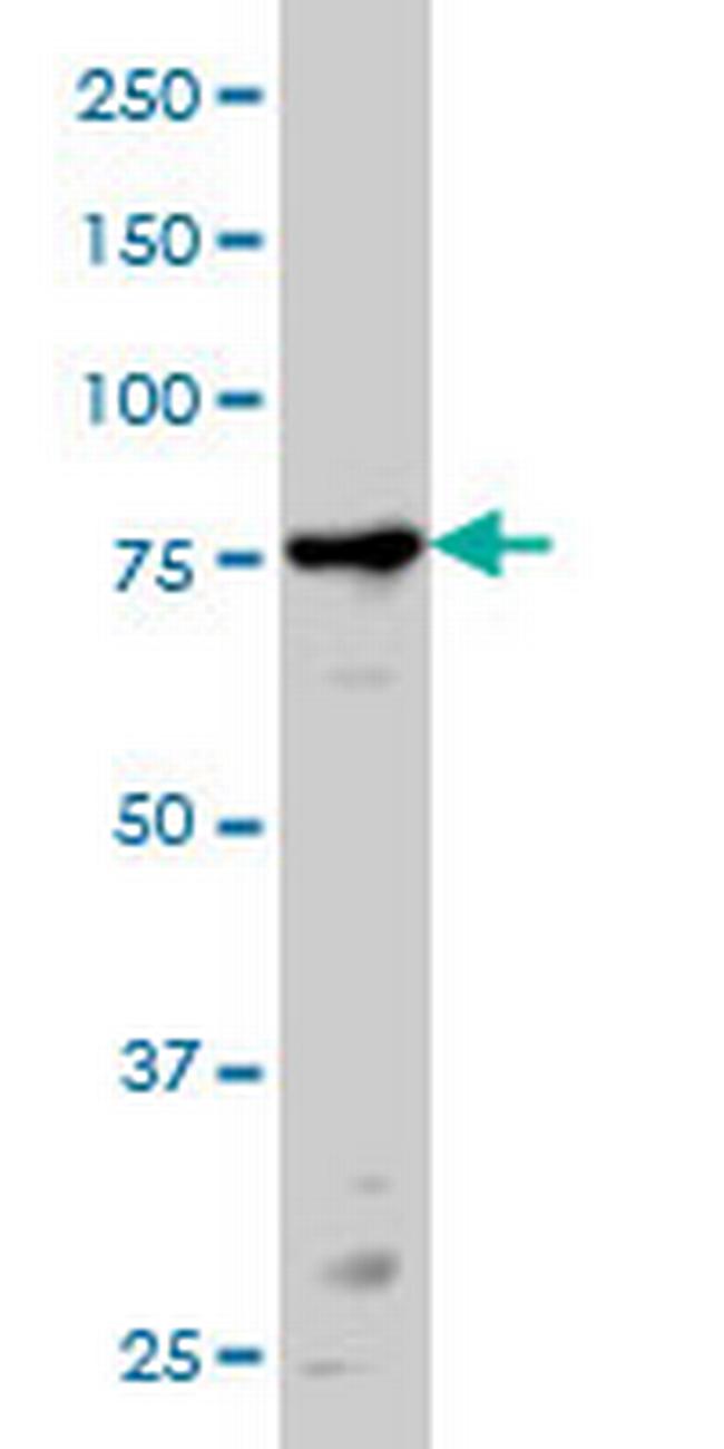 PRKCA Antibody in Western Blot (WB)