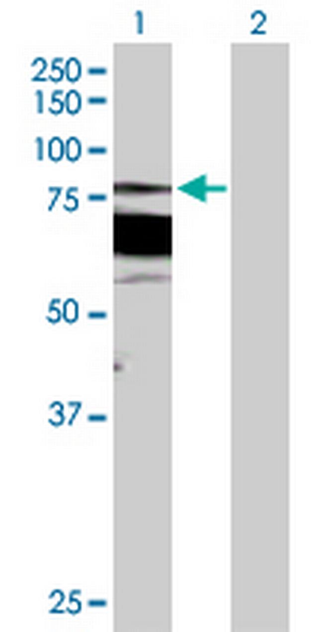 PRKCB Antibody in Western Blot (WB)
