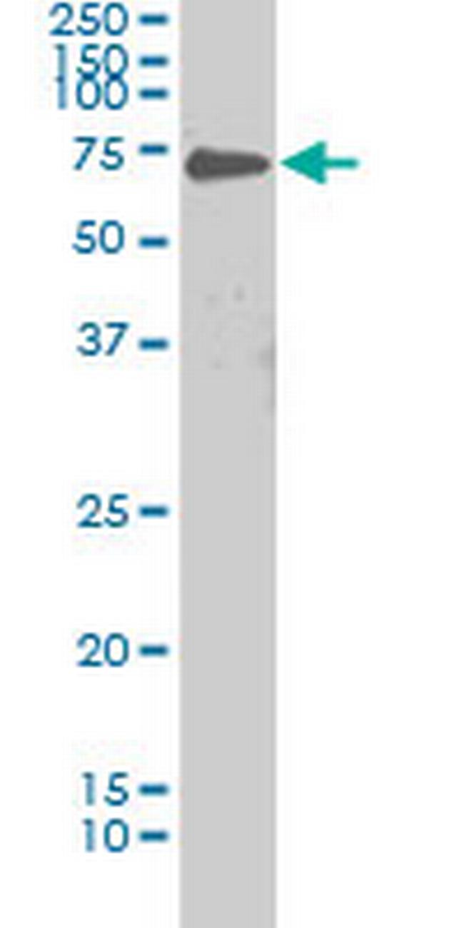 PRKCI Antibody in Western Blot (WB)