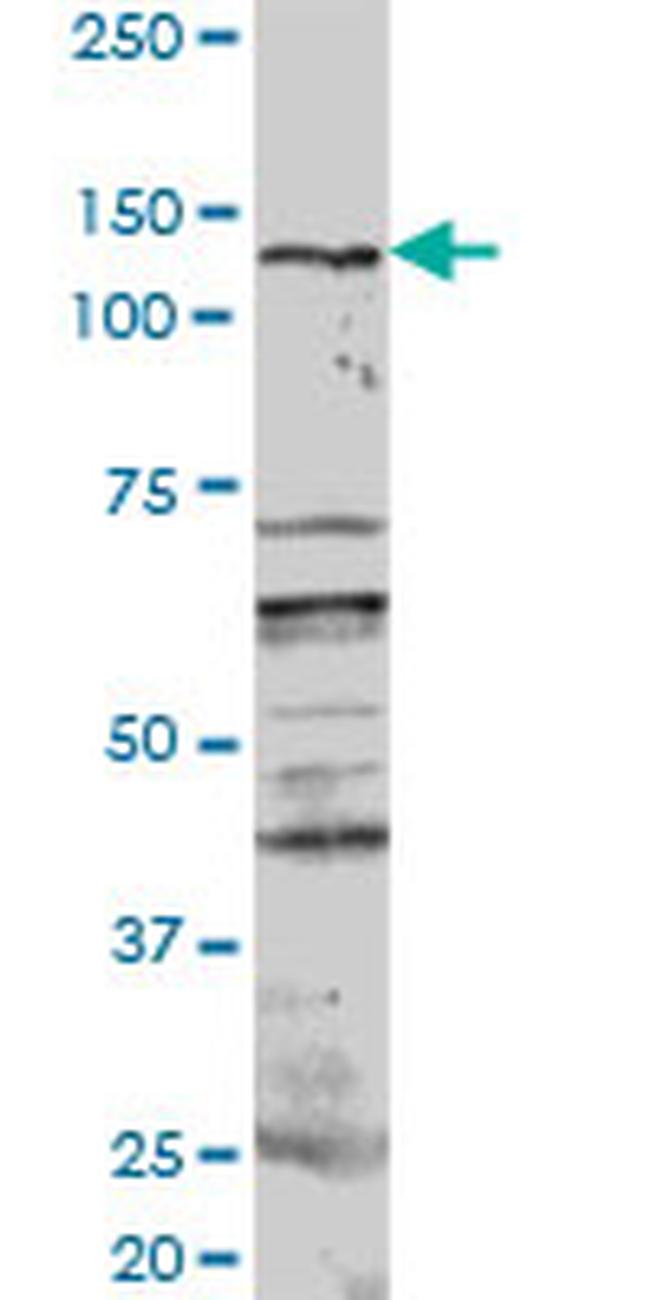 PKN1 Antibody in Western Blot (WB)