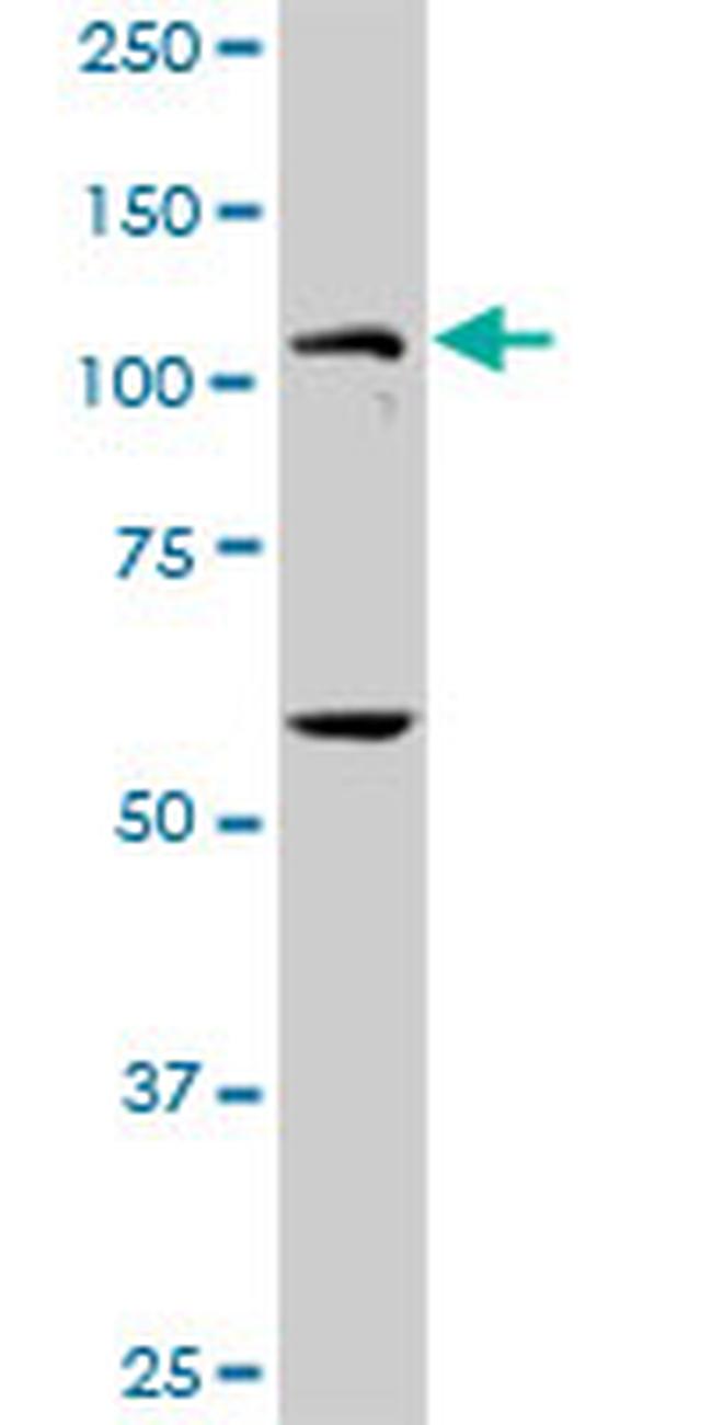 PKN1 Antibody in Western Blot (WB)