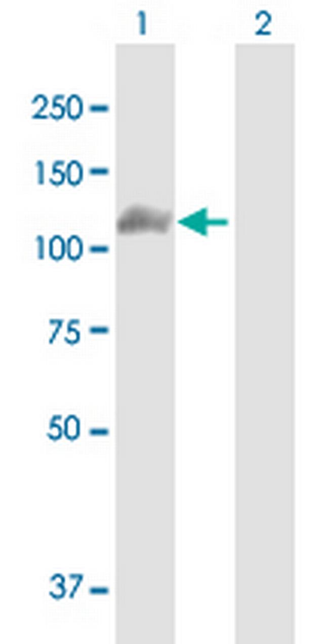 PRKD1 Antibody in Western Blot (WB)