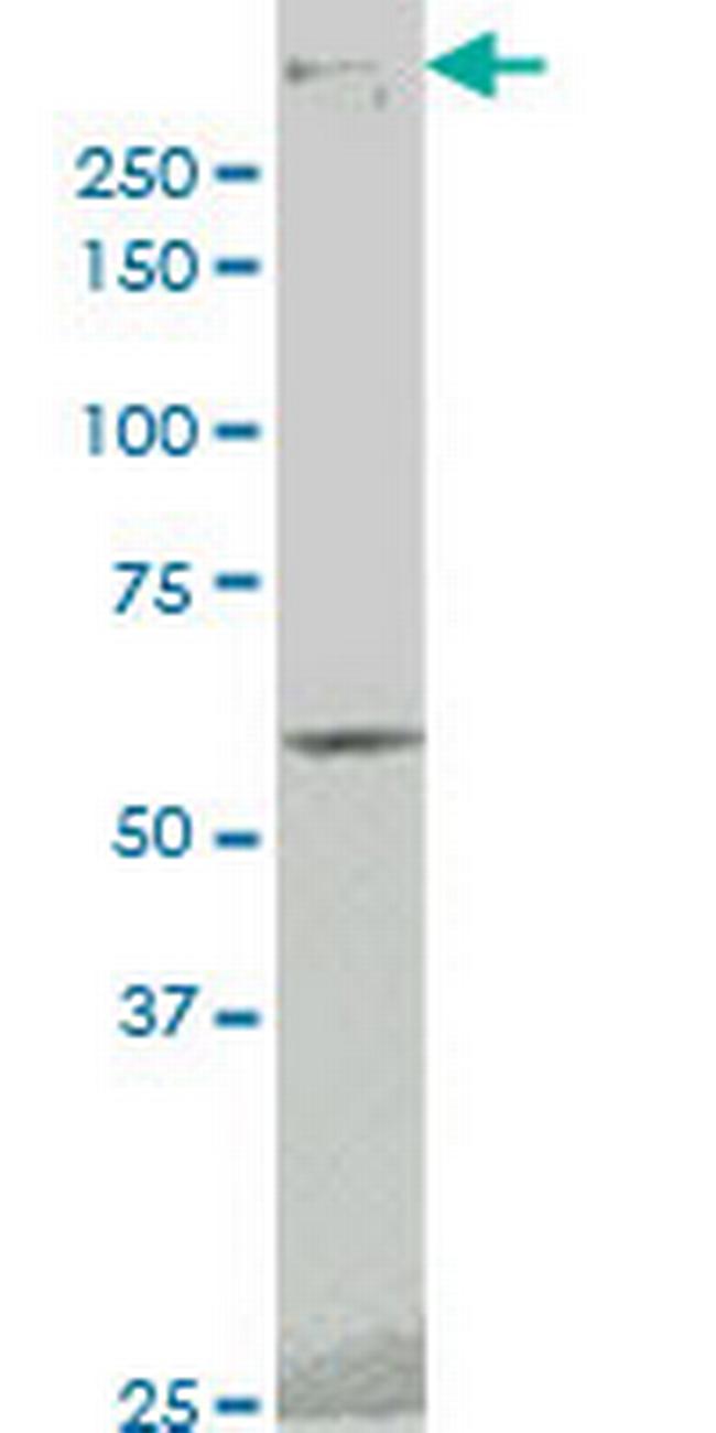 PRKDC Antibody in Western Blot (WB)