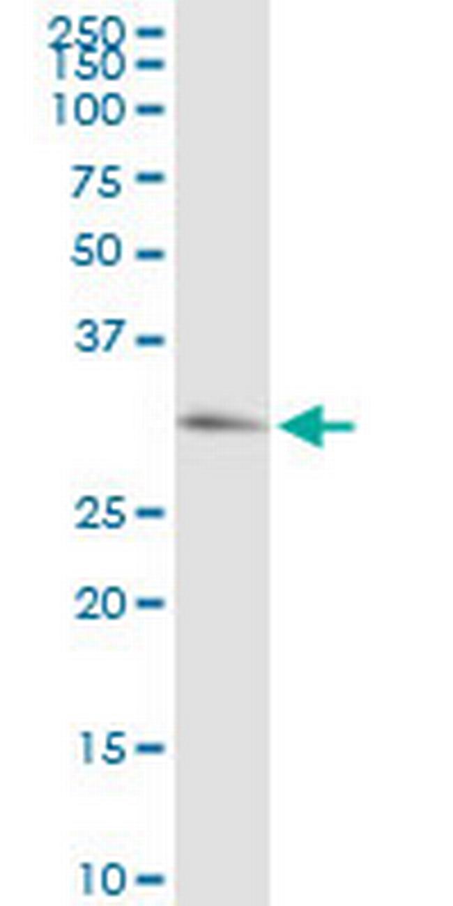 PRKG1 Antibody in Western Blot (WB)