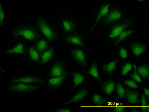 MAPK3 Antibody in Immunocytochemistry (ICC/IF)