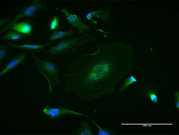 MAPK8 Antibody in Immunocytochemistry (ICC/IF)