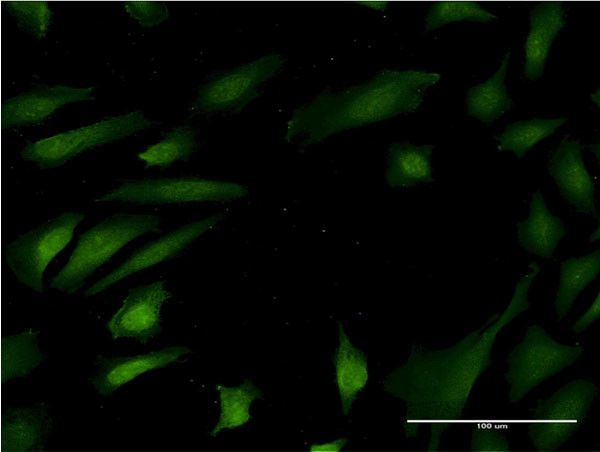 MAPK8 Antibody in Immunocytochemistry (ICC/IF)