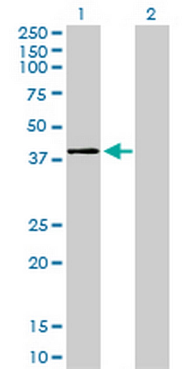 MAPK11 Antibody in Western Blot (WB)