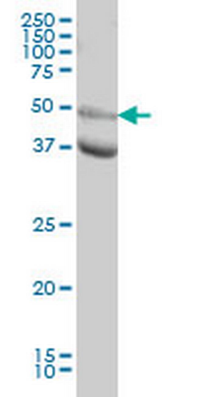 MAPK10 Antibody in Western Blot (WB)