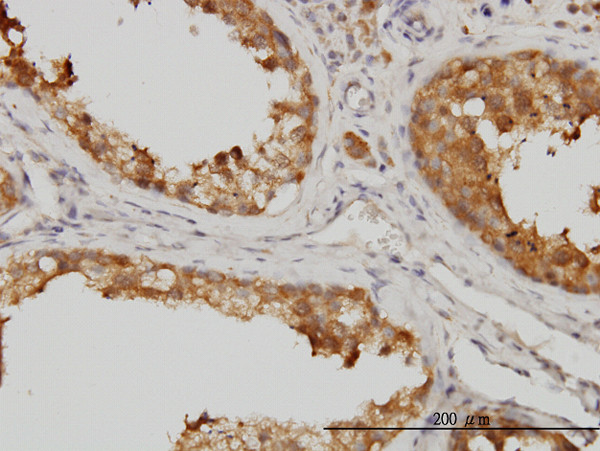 MAPK13 Antibody in Immunohistochemistry (Paraffin) (IHC (P))