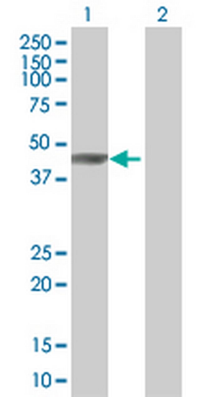 MAP2K7 Antibody in Western Blot (WB)