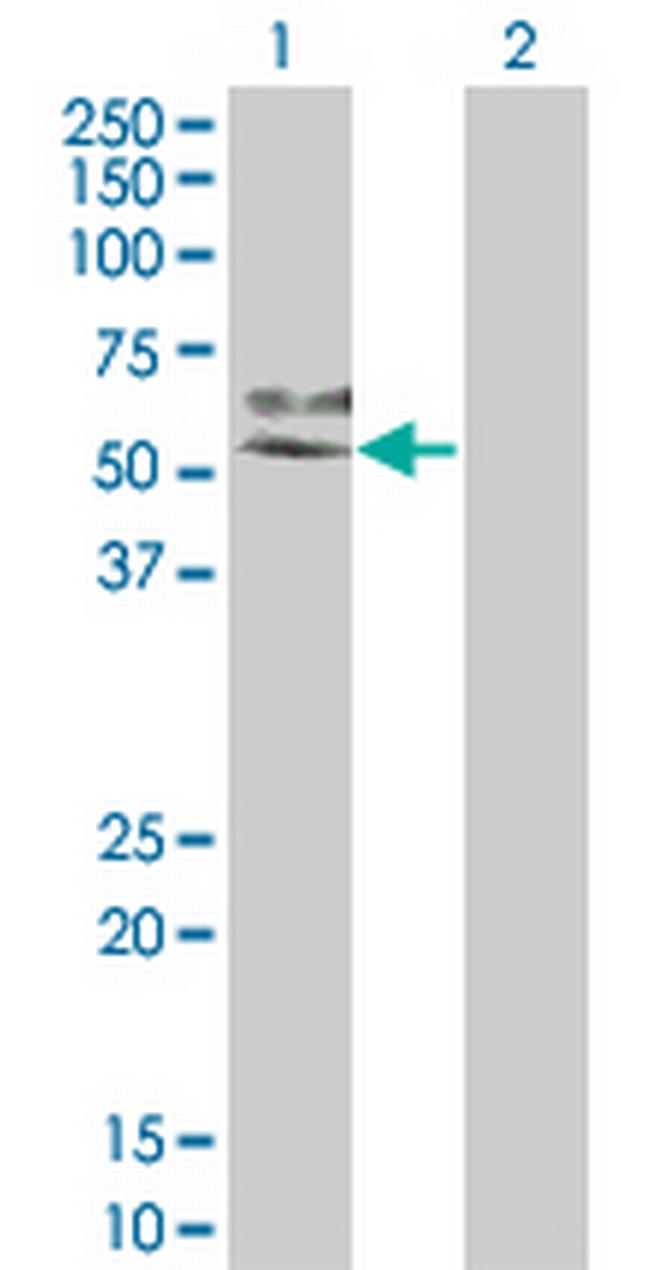 MAP2K7 Antibody in Western Blot (WB)