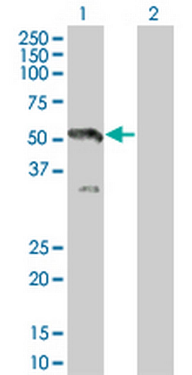 MAP2K7 Antibody in Western Blot (WB)