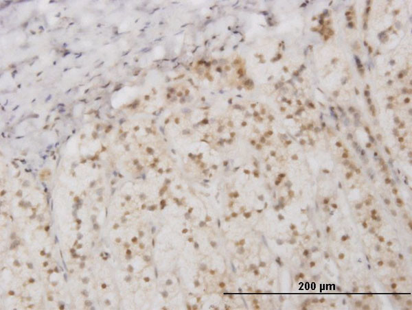 EIF2AK2 Antibody in Immunohistochemistry (Paraffin) (IHC (P))