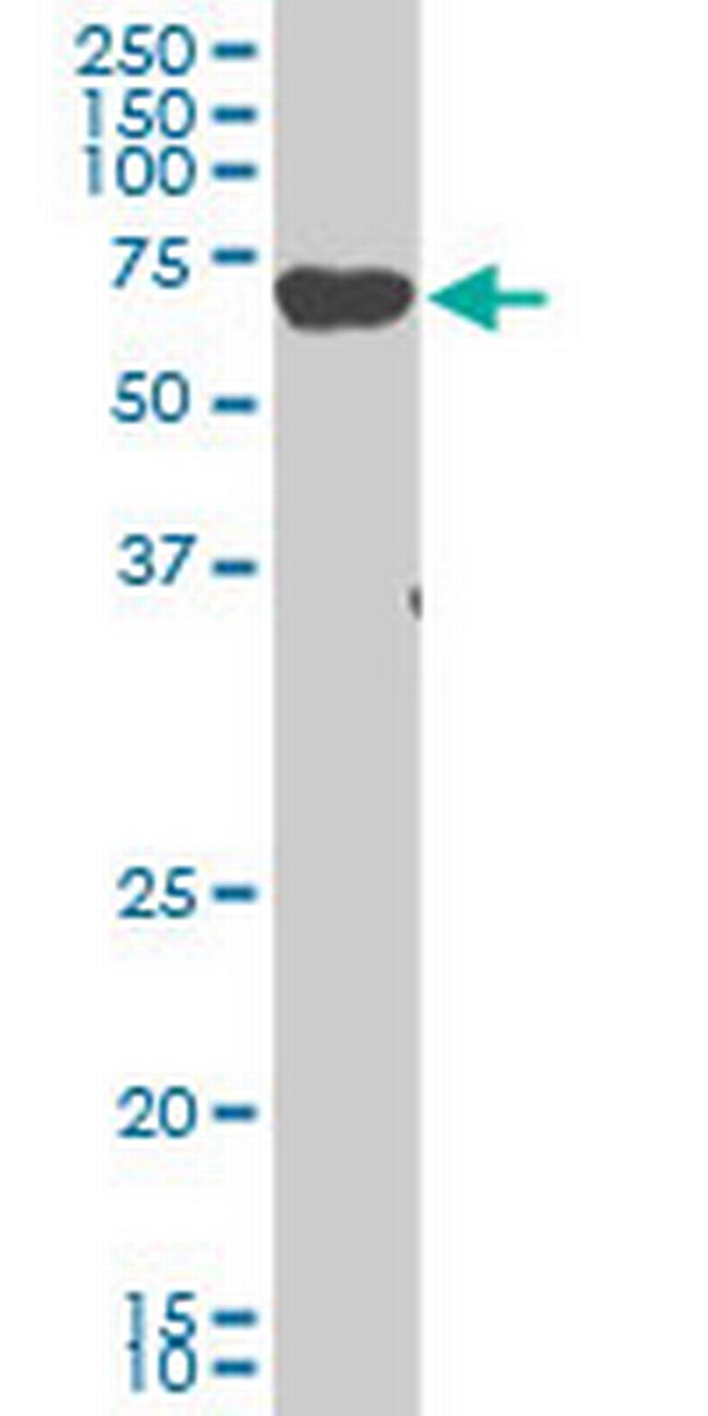 EIF2AK2 Antibody in Western Blot (WB)