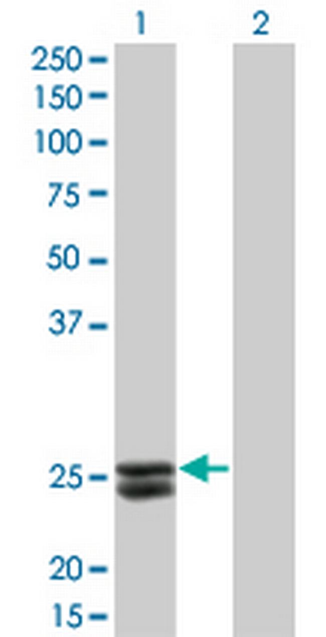 PRL Antibody in Western Blot (WB)