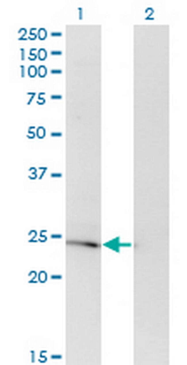 PRL Antibody in Western Blot (WB)