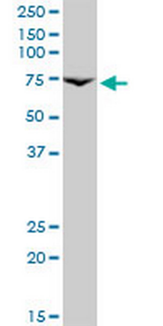 PRLR Antibody in Western Blot (WB)