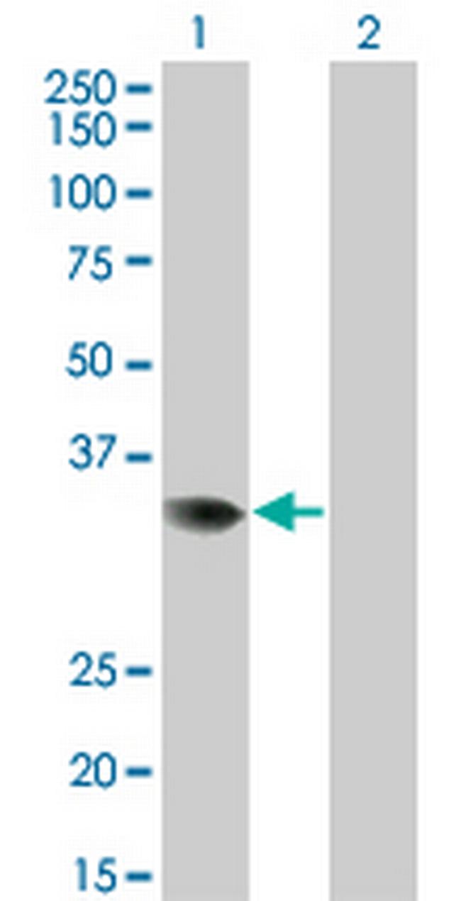 PRPS2 Antibody in Western Blot (WB)