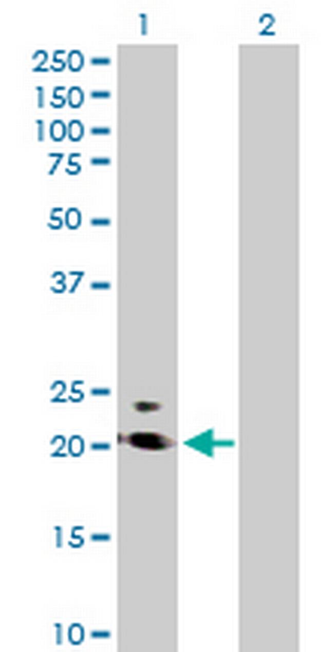 PRRG2 Antibody in Western Blot (WB)