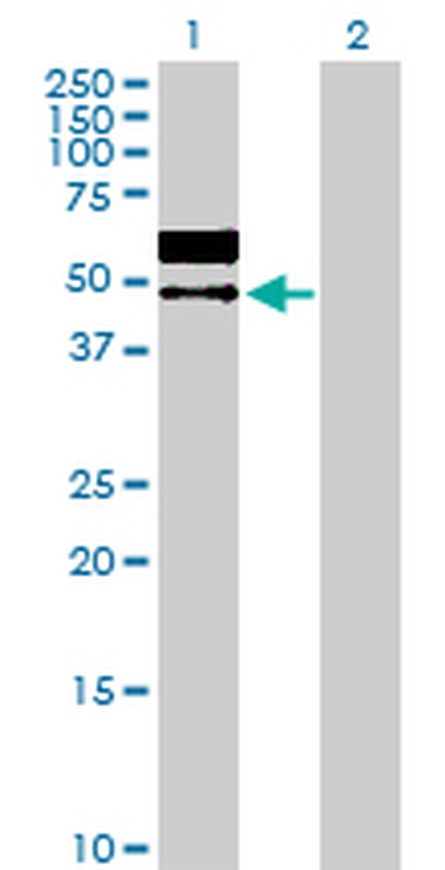 LGMN Antibody in Western Blot (WB)