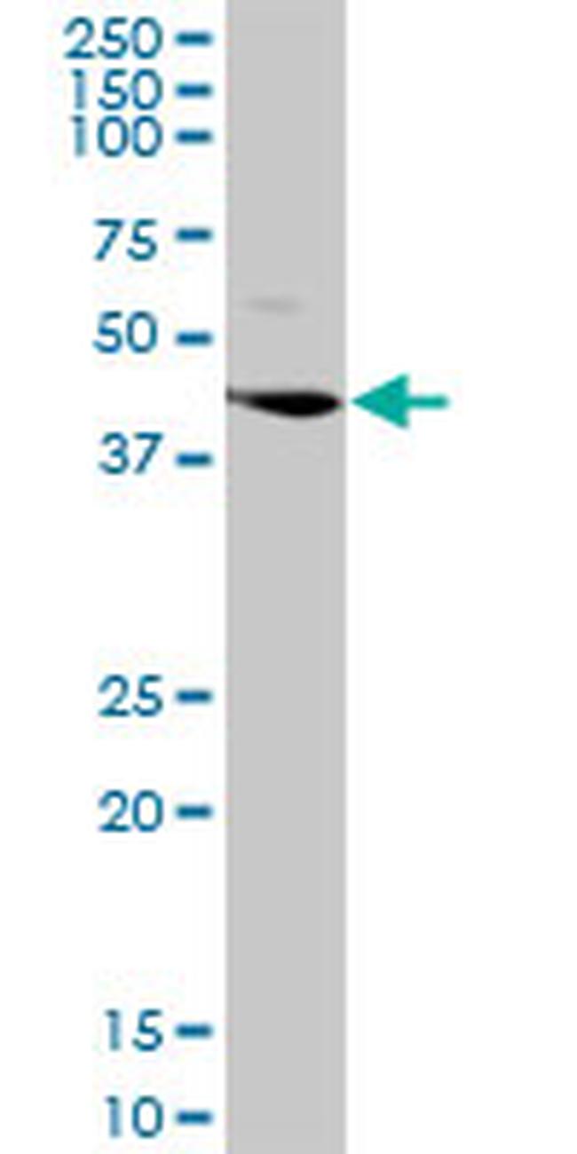 LGMN Antibody in Western Blot (WB)