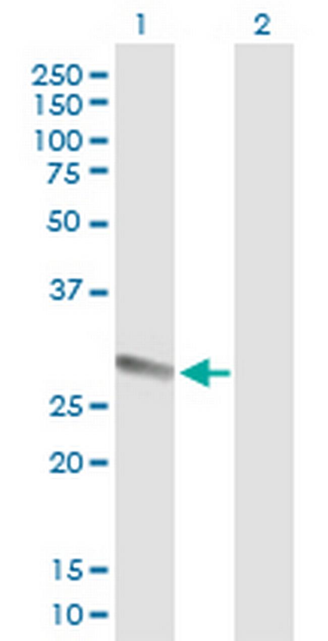 PRSS1 Antibody in Western Blot (WB)