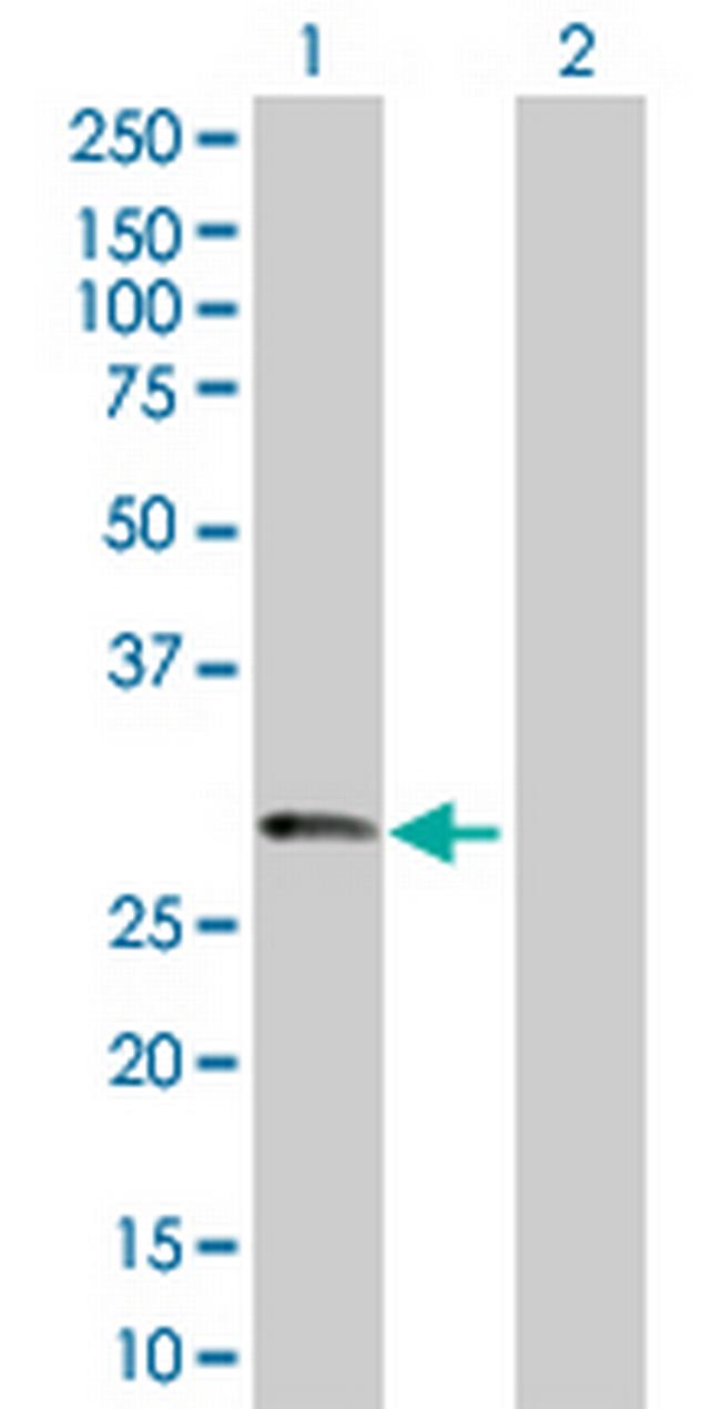 PRSS1 Antibody in Western Blot (WB)