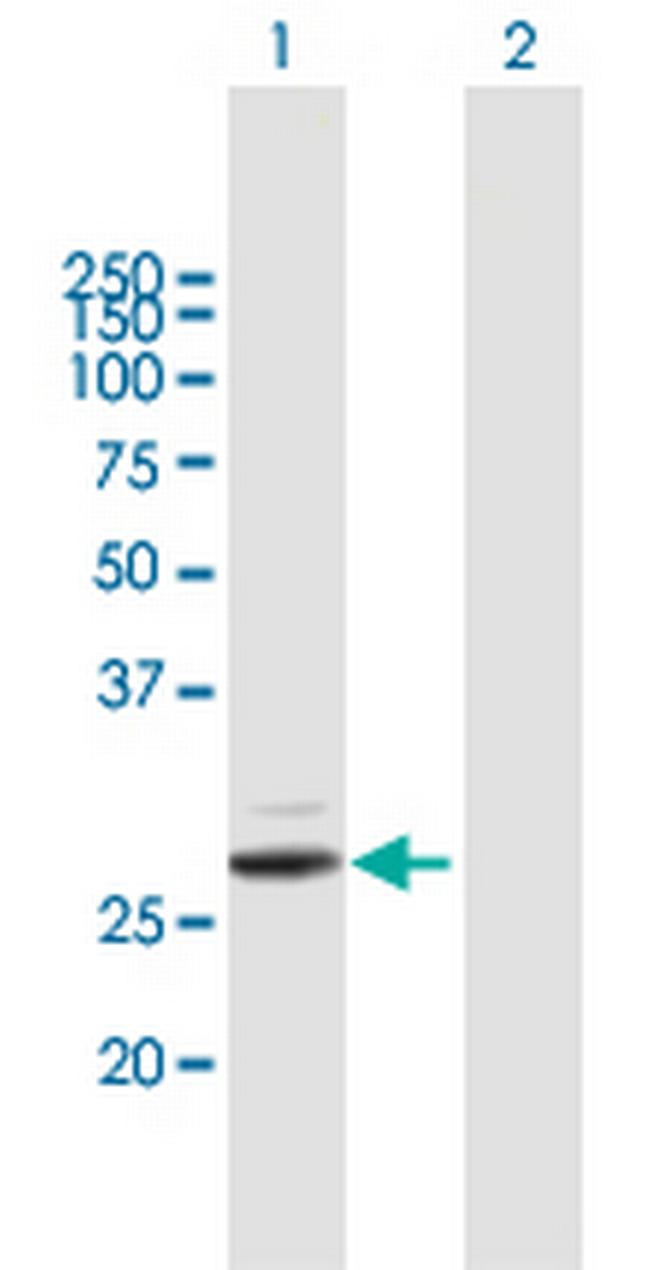 PRSS2 Antibody in Western Blot (WB)