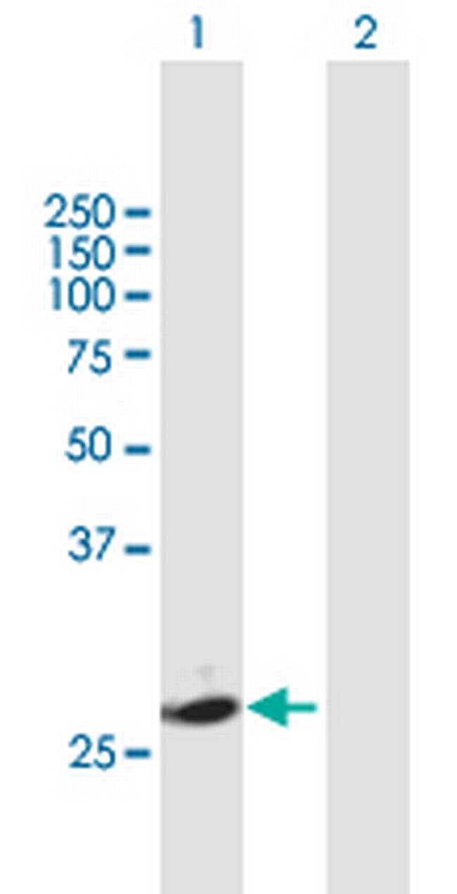 KLK7 Antibody in Western Blot (WB)