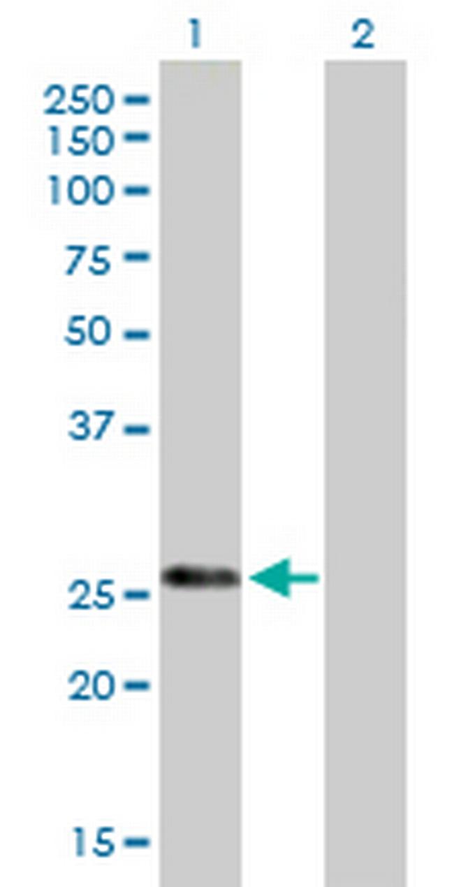 KLK7 Antibody in Western Blot (WB)