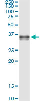 PRSS8 Antibody in Immunoprecipitation (IP)