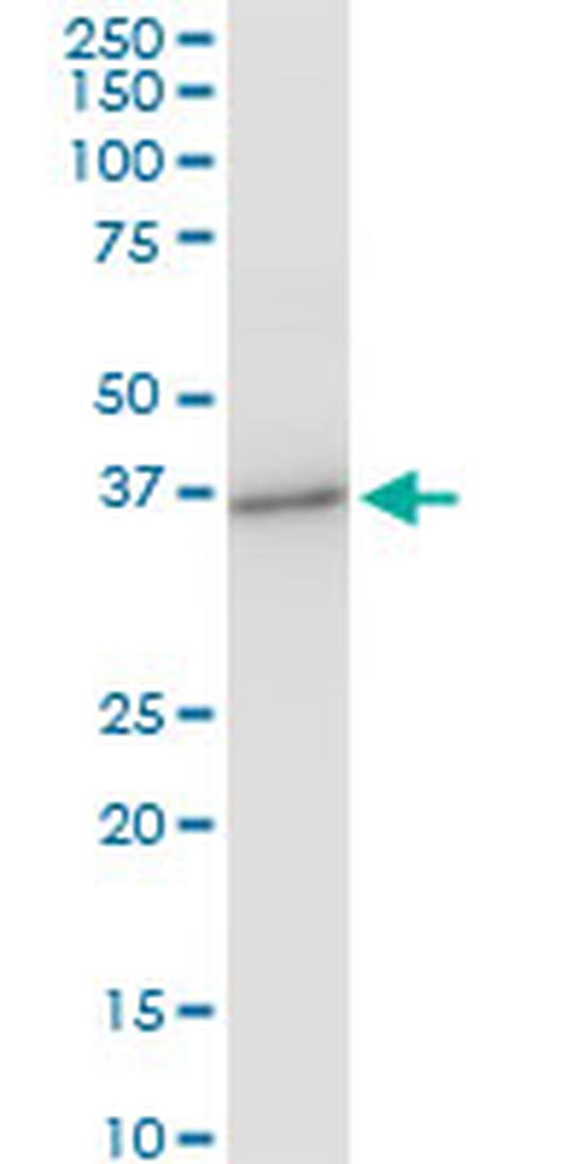 PRSS8 Antibody in Western Blot (WB)