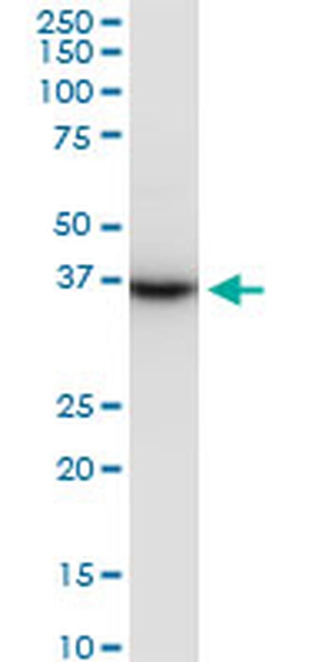 PRSS8 Antibody in Western Blot (WB)