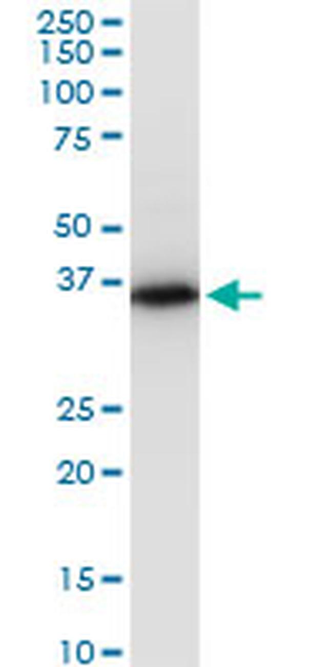 PRSS8 Antibody in Western Blot (WB)