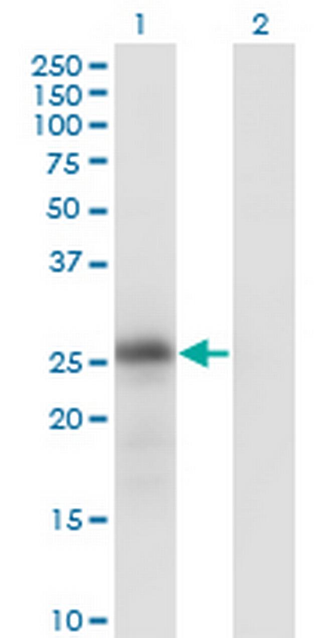 KLK6 Antibody in Western Blot (WB)