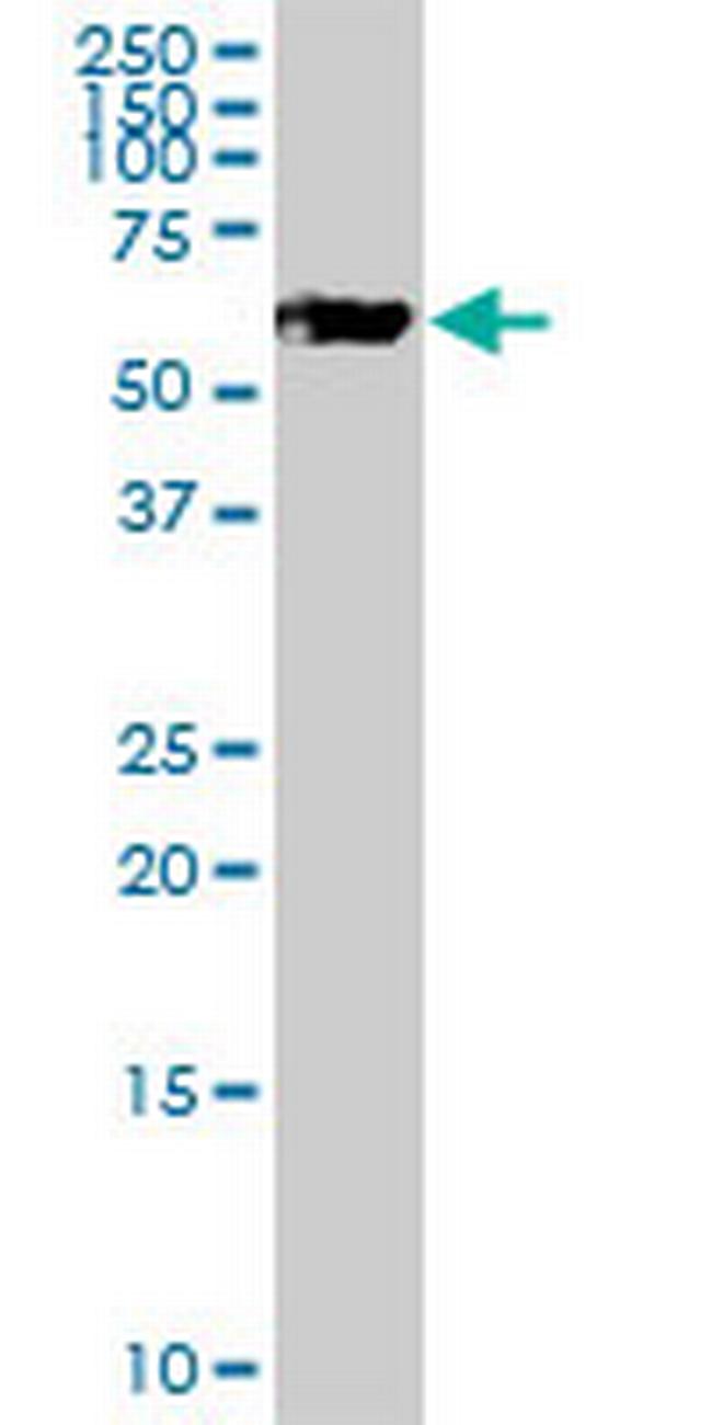 PSAP Antibody in Western Blot (WB)