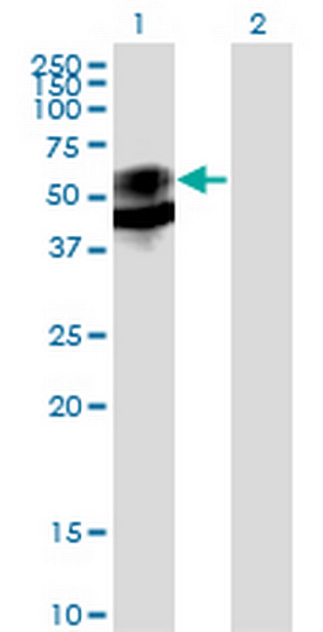 PSAP Antibody in Western Blot (WB)