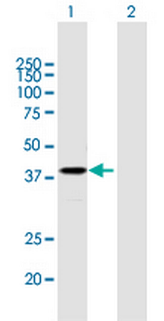 PSG2 Antibody in Western Blot (WB)