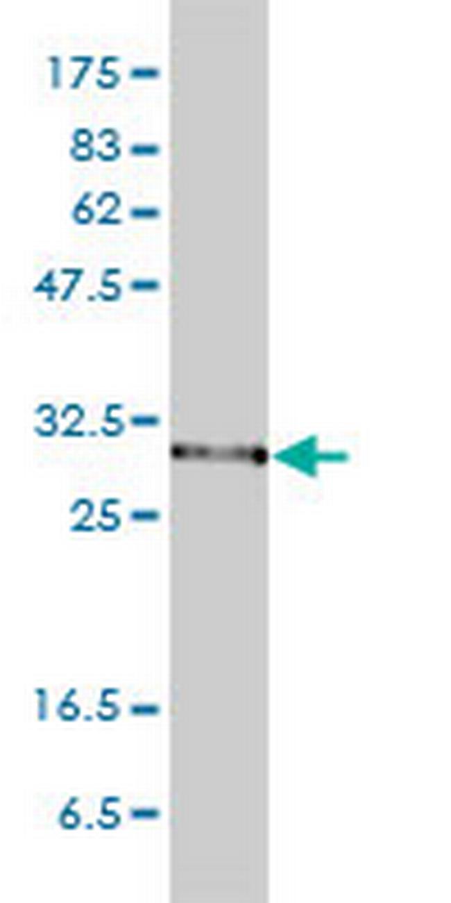 PSMA1 Antibody in Western Blot (WB)