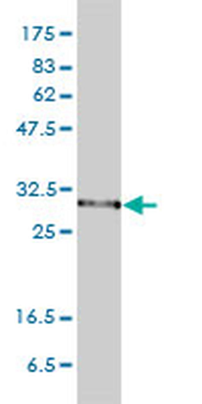 PSMA1 Antibody in Western Blot (WB)