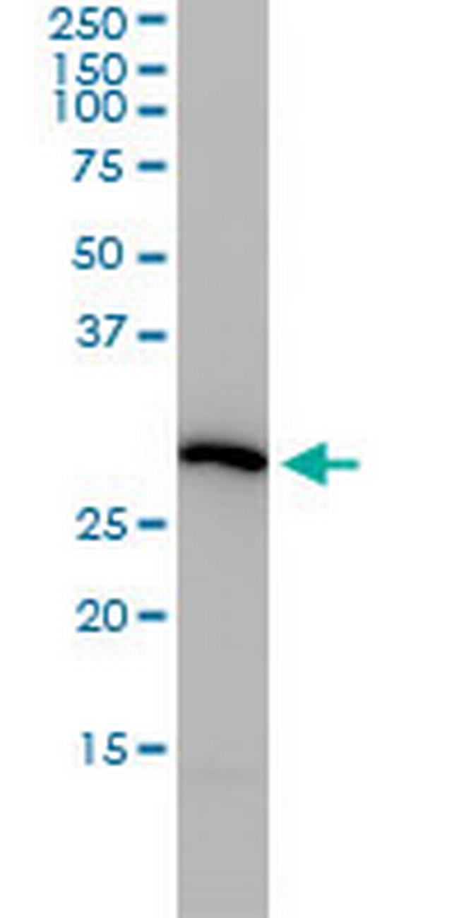 PSMA4 Antibody in Western Blot (WB)