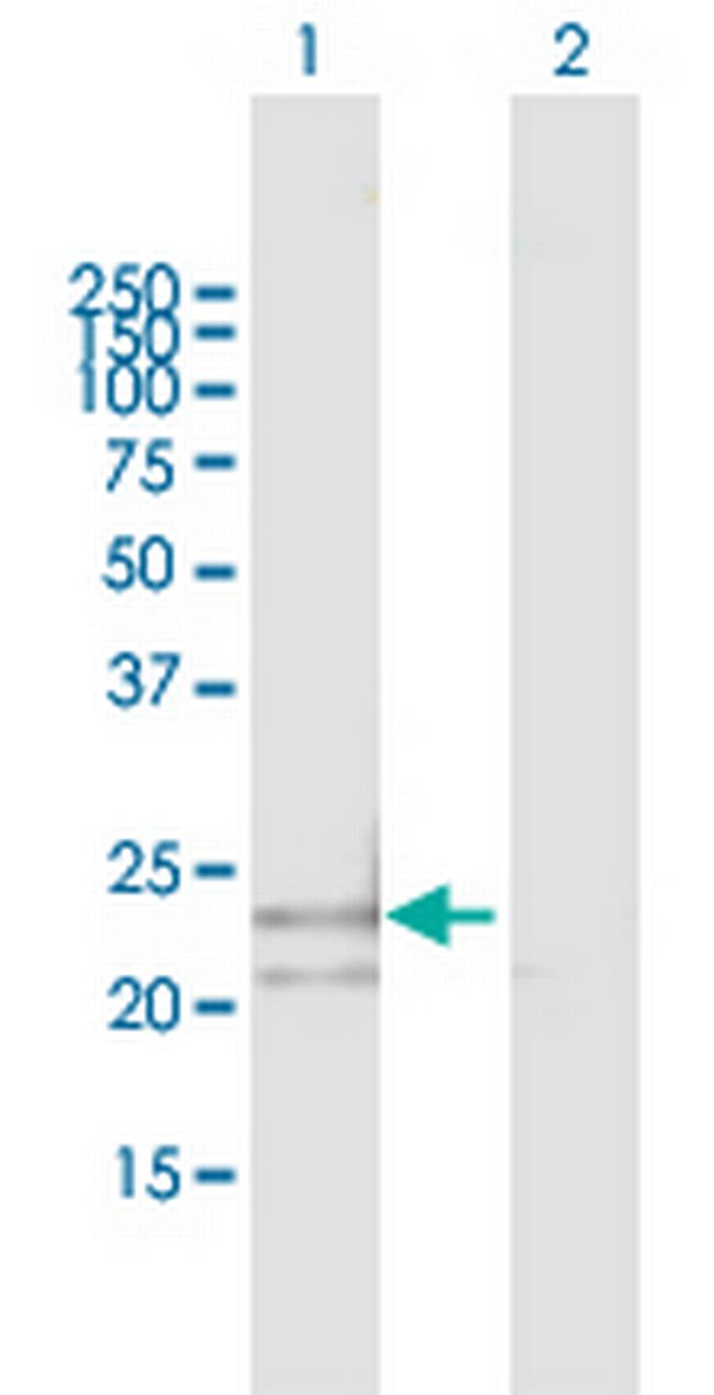 PSMB3 Antibody in Western Blot (WB)